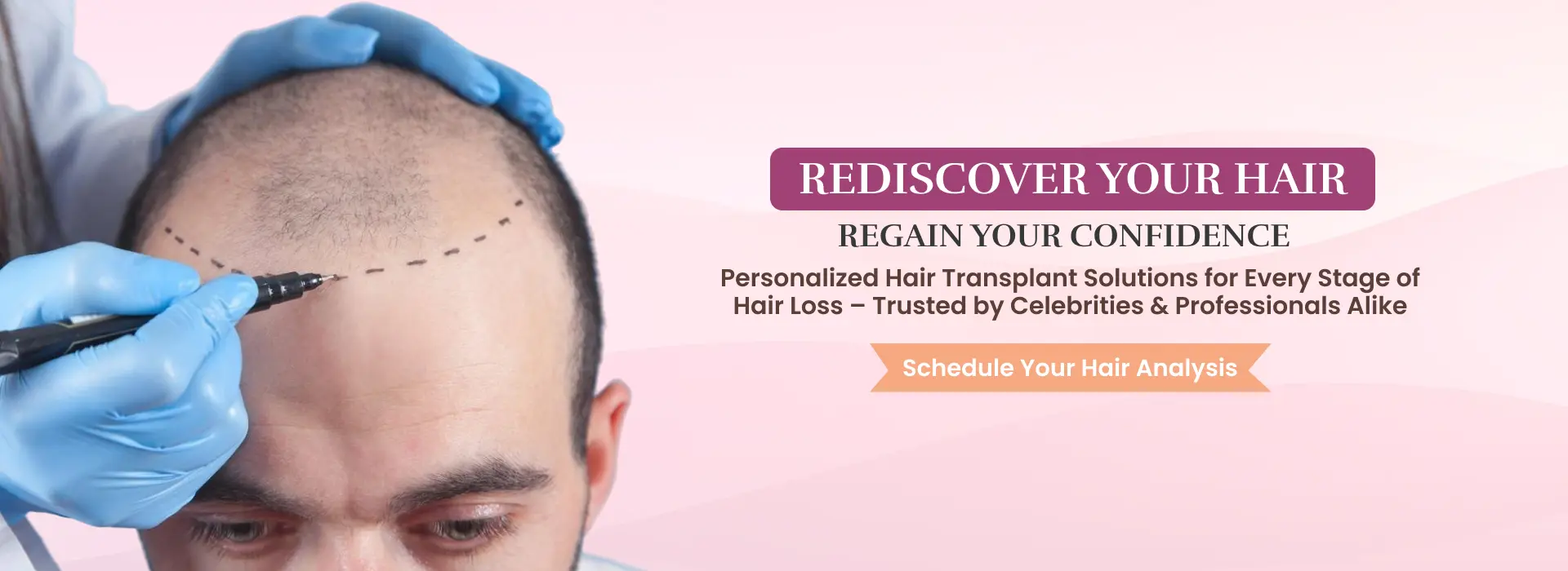 Hair Transplant (2)
