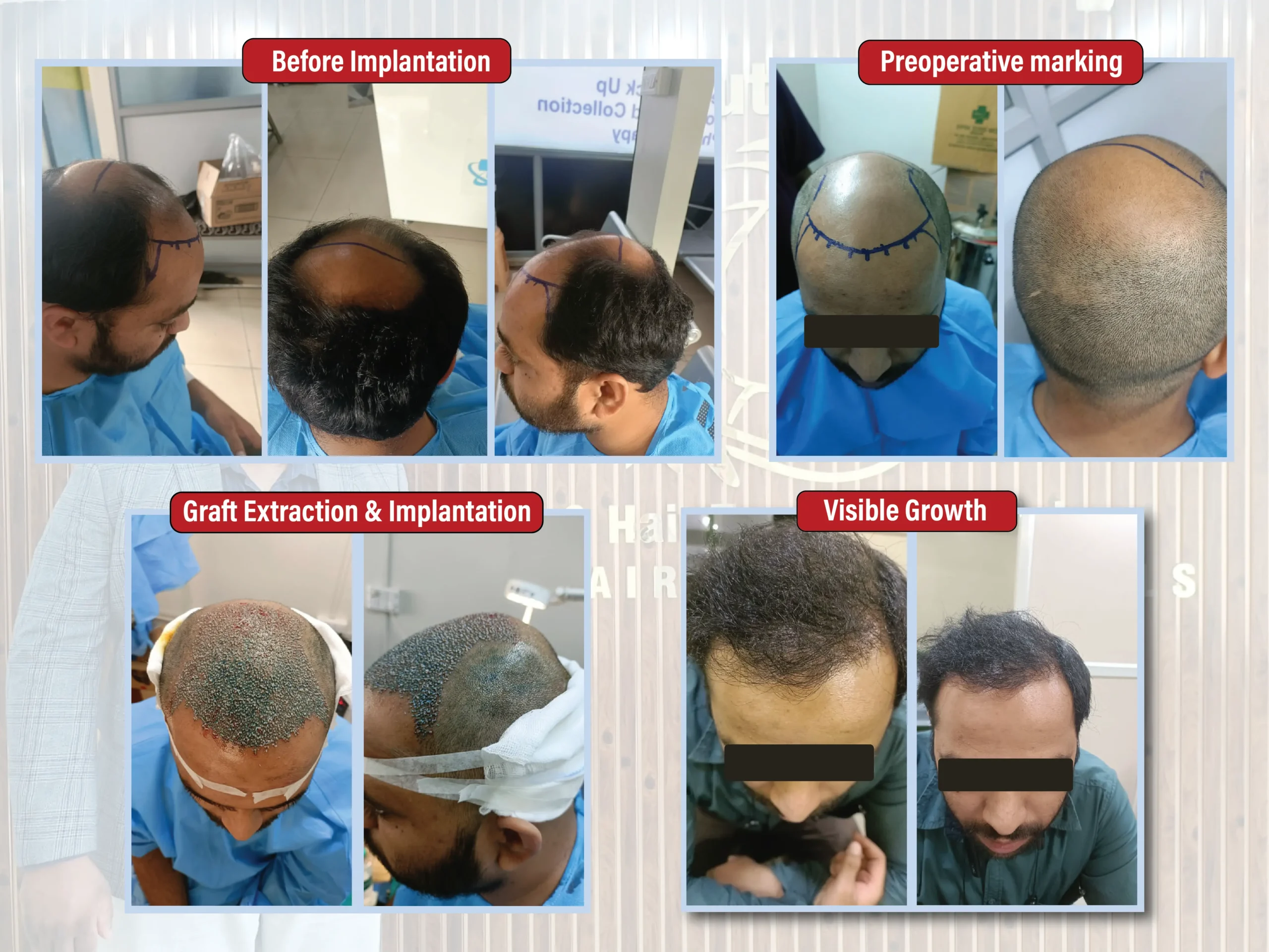 Kiran Puttaramaiah - images-01 (1)