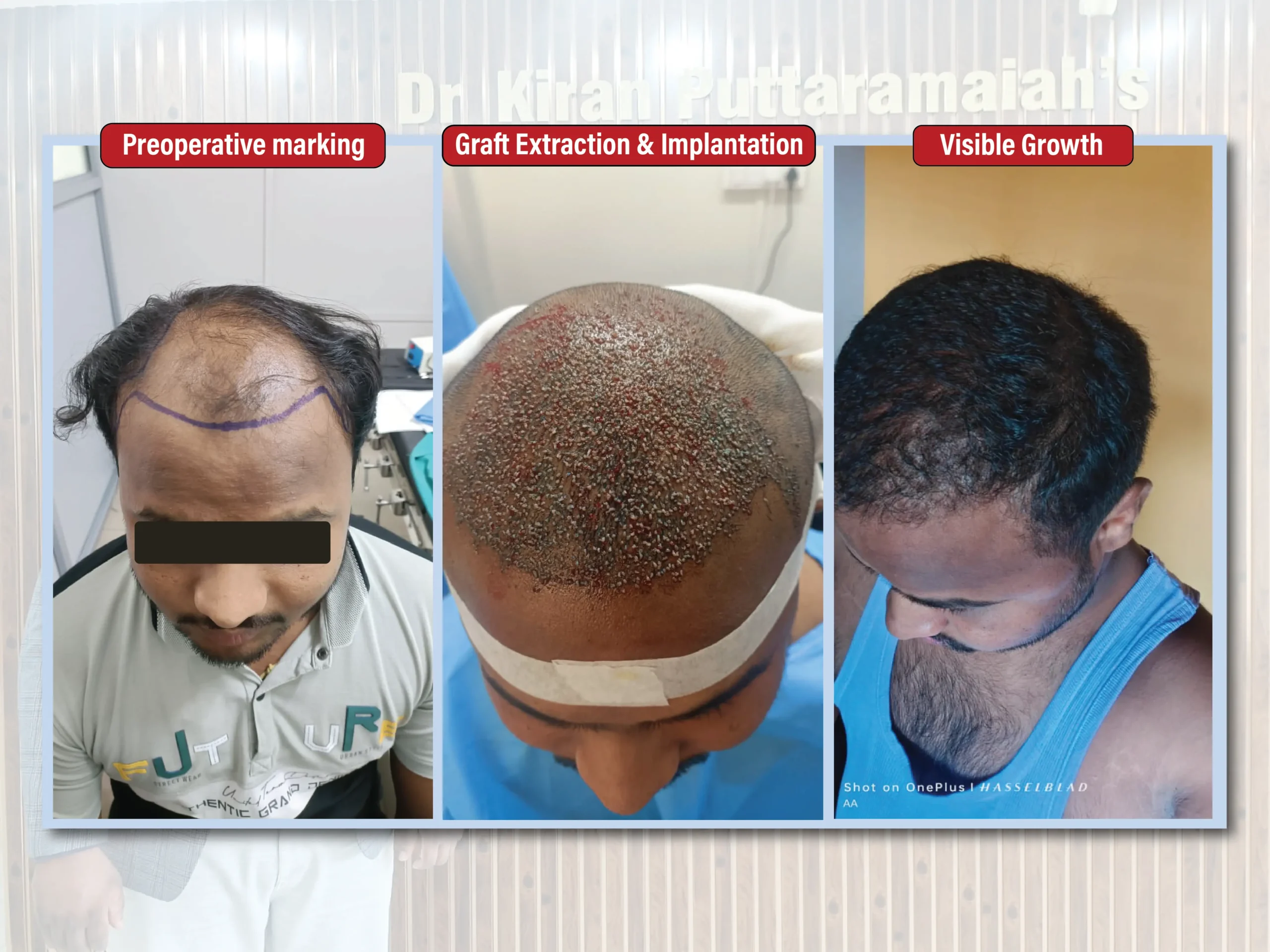 Kiran Puttaramaiah - images-02 (1)