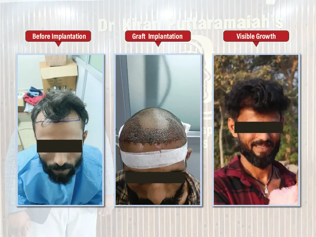 Kiran Puttaramaiah - images-03 (1)