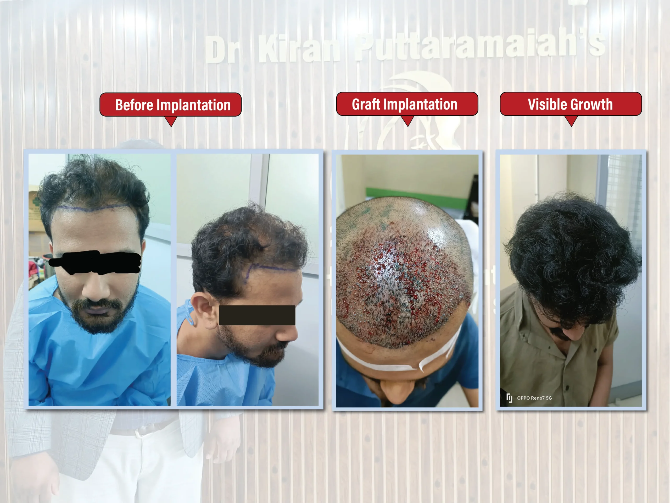 Kiran Puttaramaiah - images-04 (1)