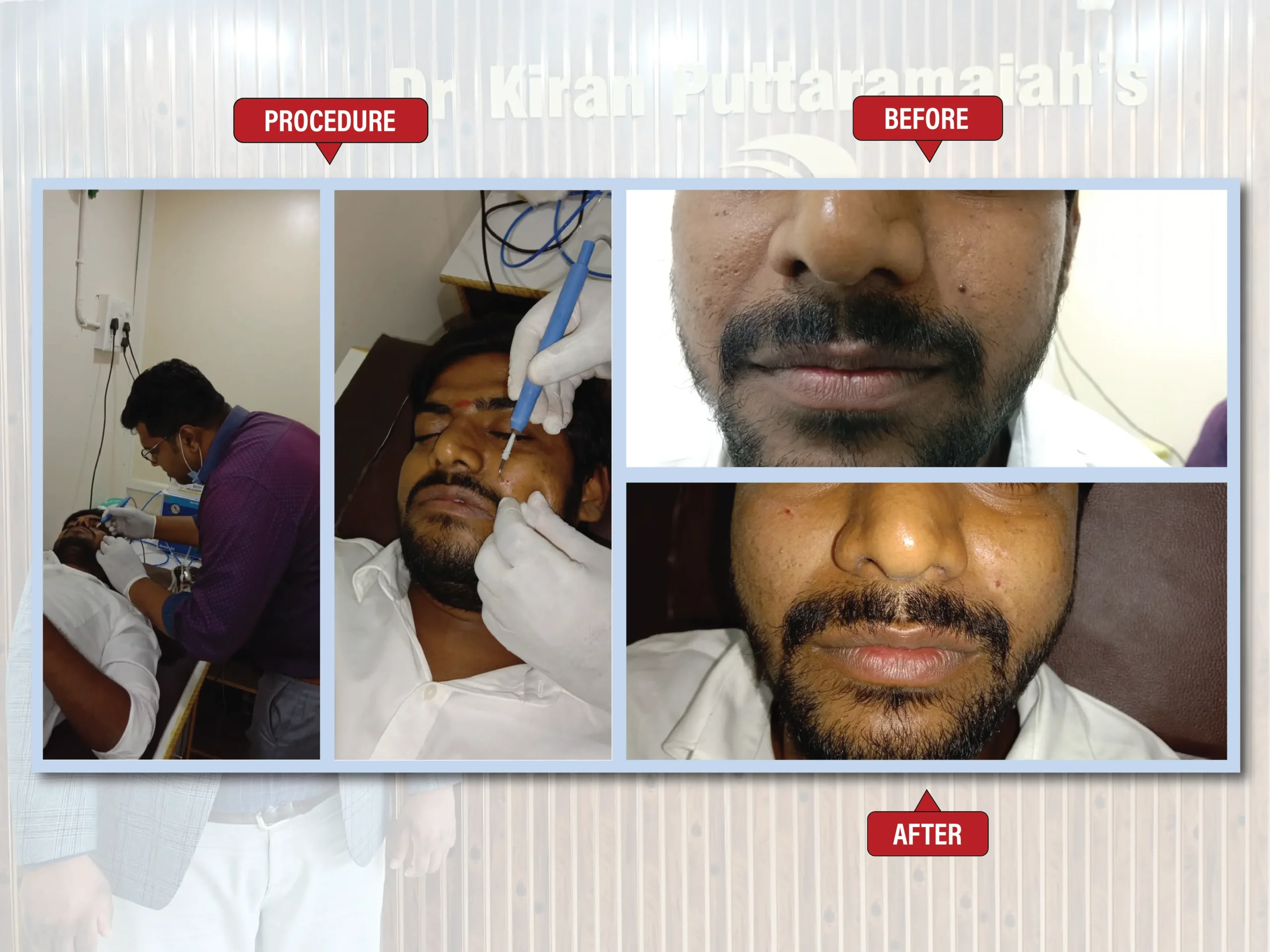 Kiran Puttaramaiah - images-05 (1)